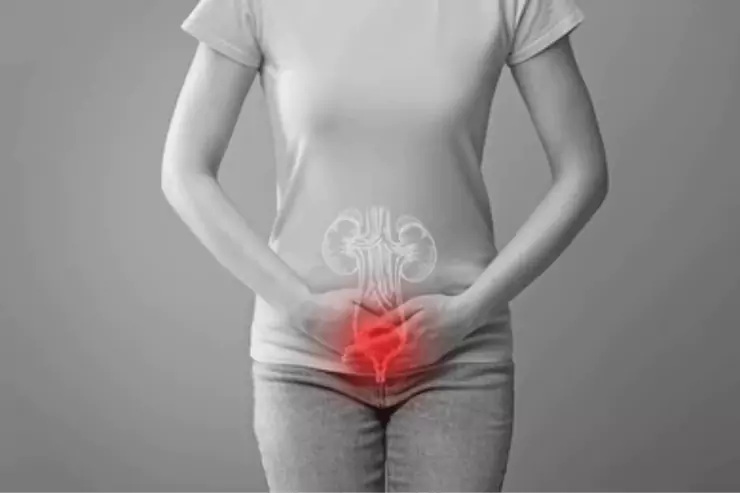 Female Urinary Tract Infections (UTIs)
