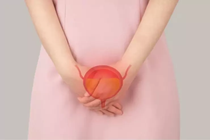 Urinary Retention & Obstruction